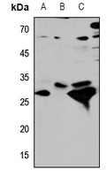 1 - Anti-Cathepsin D Antibody AP51130