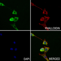 3 - Anti-Cathepsin E Antibody AP51131