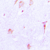 19 - Anti-Cathepsin E Antibody AP51131