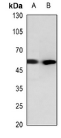 1 - Anti-Cathepsin E Antibody AP51131