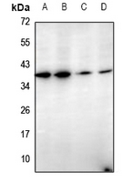 1 - Anti-Cathepsin G Antibody AP51132