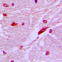 19 - Anti-CUX1 Antibody AP51134