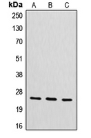 1 - Anti-CYB561D2 Antibody AP51137