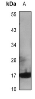1 - Anti-Cytochrome b5A Antibody AP51138