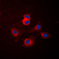 3 - Anti-Cytochrome P450 17A1 Antibody AP51140