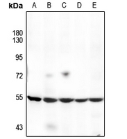 1 - Anti-Cytochrome P450 17A1 Antibody AP51140