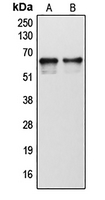 1 - Anti-Cytochrome P450 1B1 Antibody AP51142
