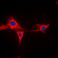 3 - Anti-Cytochrome P450 2A13 Antibody AP51144