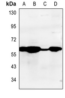 1 - Anti-Cytochrome P450 2A13 Antibody AP51144
