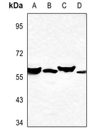 1 - Anti-Cytochrome P450 2A7 Antibody AP51145
