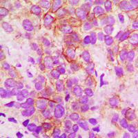 19 - Anti-Cytochrome P450 2B6 Antibody AP51146