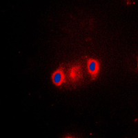 3 - Anti-Cytochrome P450 2J2 Antibody AP51147