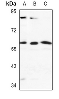 1 - Anti-Cytochrome P450 2J2 Antibody AP51147