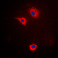 3 - Anti-Cytochrome P450 2U1 Antibody AP51148