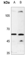 1 - Anti-Cytochrome P450 2U1 Antibody AP51148