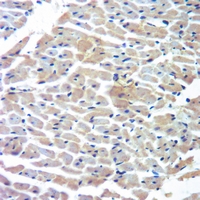 19 - Anti-Cytochrome P450 4A11/22 Antibody AP51150