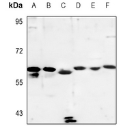 1 - Anti-Cytochrome P450 4A11/22 Antibody AP51150