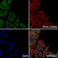 3 - Anti-Cytochrome P450 4F2 Antibody AP51151
