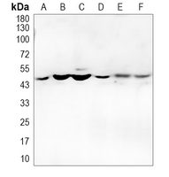 1 - Anti-Cytochrome P450 4F2 Antibody AP51151