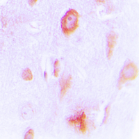 19 - Anti-Cytochrome P450 4X1 Antibody AP51152