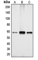 1 - Anti-Cytochrome P450 4X1 Antibody AP51152