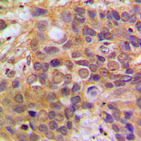 19 - Anti-DAXX Antibody AP51155