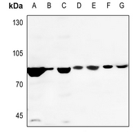 1 - Anti-DAXX Antibody AP51155