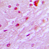19 - Anti-DBF4 Antibody AP51156