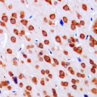19 - Anti-DCLK3 Antibody AP51157