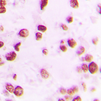 19 - Anti-Artemis (Phospho-S516) Antibody AP51158