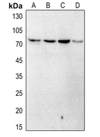1 - Anti-Artemis (Phospho-S516) Antibody AP51158