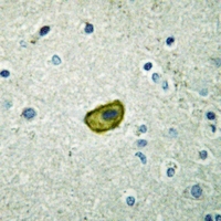 19 - Anti-Dynactin p50 Antibody AP51160