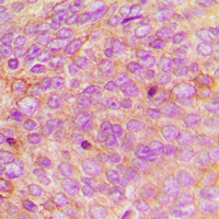 19 - Anti-Defensin alpha 1 Antibody AP51161