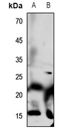 1 - Anti-Defensin alpha 1 Antibody AP51161
