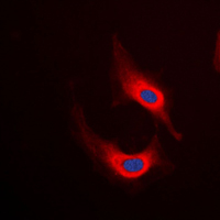 3 - Anti-Desmin Antibody AP51162