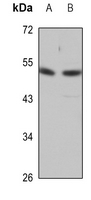 1 - Anti-Desmin Antibody AP51162