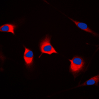 3 - Anti-DFF45 Antibody AP51163