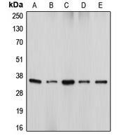 1 - Anti-DFF45 Antibody AP51163
