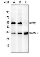 1 - Anti-DFNA5 Antibody AP51164