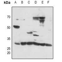 1 - Anti-DLX5 Antibody AP51165