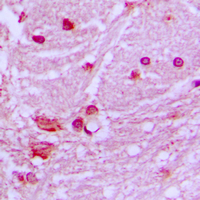 19 - Anti-DNAL1 Antibody AP51167