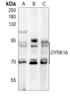 1 - Anti-DYRK1A Antibody AP51170