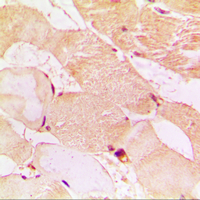 19 - Anti-Dysferlin Antibody AP51171
