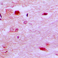 19 - Anti-E2F6 Antibody AP51174