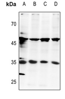1 - Anti-E2F6 Antibody AP51174