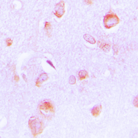 19 - Anti-PECI Antibody AP51175