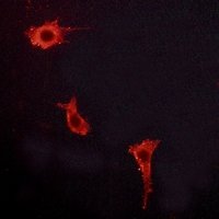 3 - Anti-Endothelin A Receptor Antibody AP51176