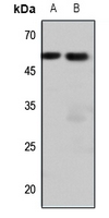 1 - Anti-Endothelin A Receptor Antibody AP51176