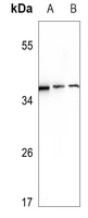 1 - Anti-Ephrin A3 Antibody AP51179