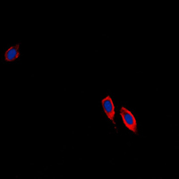 3 - Anti-Ephrin B3 Antibody AP51181